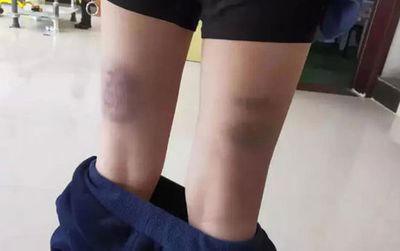 Phẫn nộ với hình phạt học tập của giáo viên: Thấp hơn 1 điểm đánh 10 roi, có em bị đánh tới 840 roi