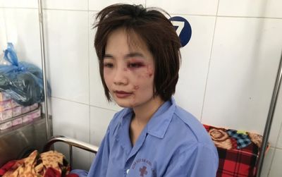 Nữ phụ xe buýt bị nhóm thanh niên xăm trổ hành hung: 'Tôi cảm thấy bị tổn thương, đánh tôi xong họ vứt lại 1 triệu bảo cầm mà mua thuốc'