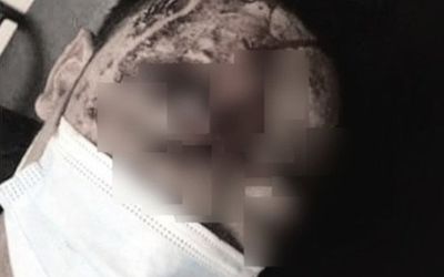 Đang ngủ cùng vợ, người đàn ông bị kẻ lạ mặt đánh trọng thương