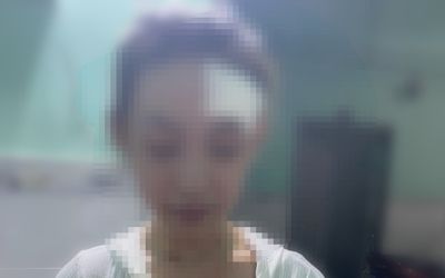 Bình Dương: Công an điều tra vụ nữ công nhân bị đánh hội đồng