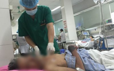 Sau bữa tiết canh lợn, người đàn ông phải nhập viện cấp cứu khẩn