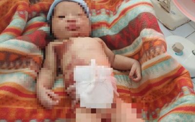 Sức khỏe bé sơ sinh bị bỏ rơi giữa rừng ở Quảng Nam đang chuyển biến xấu