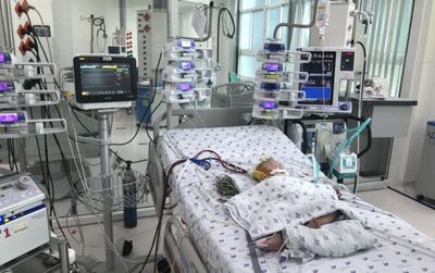 Bé 7 tháng tuổi sốc sốt xuất huyết được can thiệp ECMO cứu sống