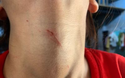 Cô gái 17 tuổi phải đối diện với cảnh kinh hoàng sau câu nói 'tao vã lắm rồi' của gã thanh niên