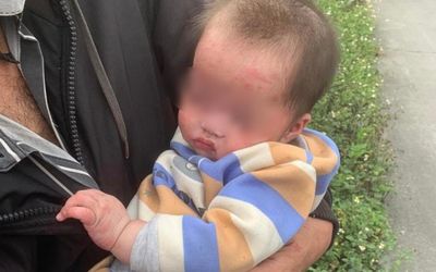 Phát hiện bé gái 7 tháng tuổi bị bỏ rơi bên vệ đường, thấy điều này trên mặt bé khiến ai cũng xót xa