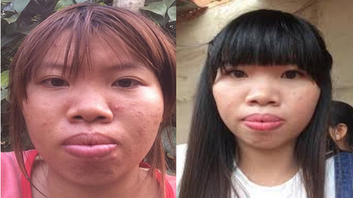 Chuyện tình nhanh như chớp của 'Thị Nở tái sinh' với trai tân 28 tuổi