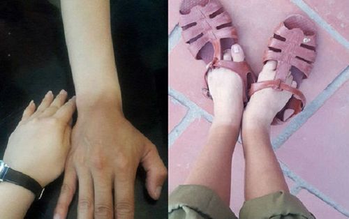 Cư dân mạng bật cười với hình ảnh 'đặc sản' sau mùa quân sự của sinh viên: Da dẻ loang lổ 2 màu vì nắng nóng