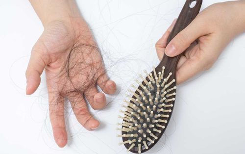 Nếu không tuổi 17 mà tóc như 71, hãy tránh xa 5 lỗi gây rụng tóc hói đầu dưới đây!