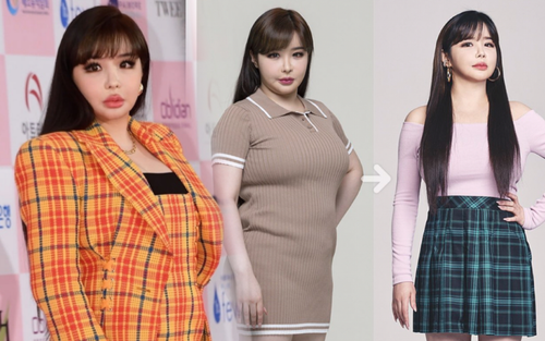 'Cô béo' Park Bom (2NE1) lột xác sau khi giảm 11kg: Mặt vẫn đơ như búp bê bị hỏng!