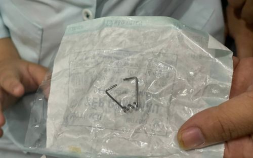 Cấp cứu bé trai 9 tuổi mắc bệnh tự kỷ nuốt lò xo vào cổ họng