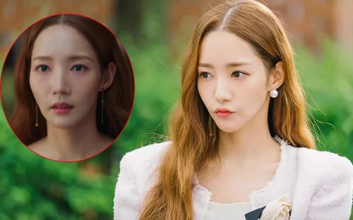 Park Min Young lộ rõ khuyết điểm về nhan sắc chỉ vì lạm dụng phẫu thuật