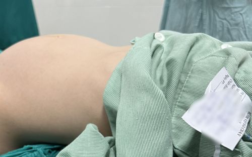 Bé gái 12 tuổi nhập viện khẩn vì bụng to bất thường