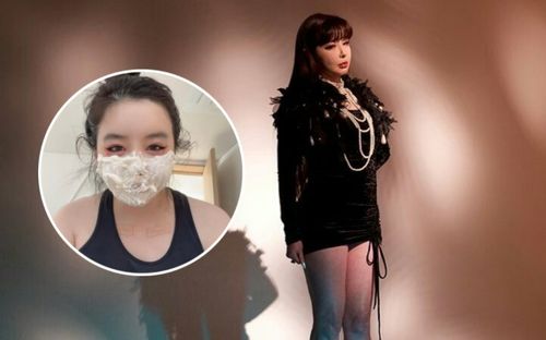 Park Bom (2NE1) để lộ dấu tích lạ trên cơ thể khiến người hâm mộ lo lắng